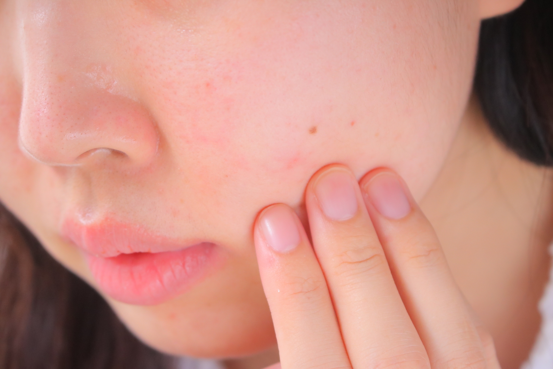 乾燥肌 女性 スキンケア